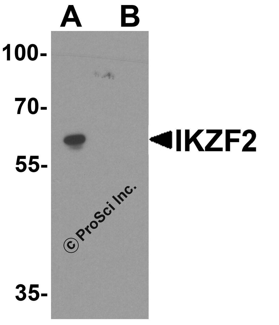 Western blot analysis of IKZF2 in EL4 cell lysate with IKZF2 antibody at 1 &#956;g/ml in (A) the absence and (B) the presence of blocking peptide.