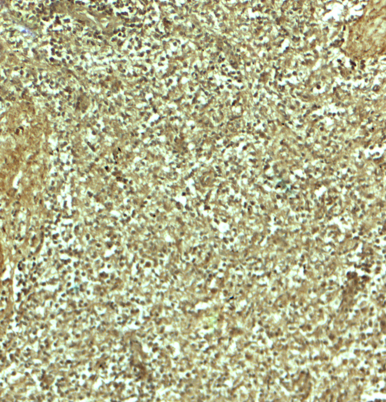 Immunohistochemistry of ADRM1 in human spleen tissue with ADRM1 antibody at 5 ug/mL.