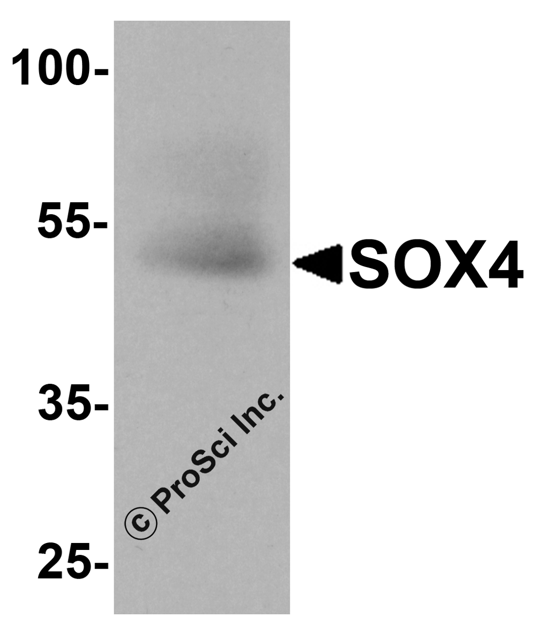 Western blot analysis of SOX4 in human testis tissue lysate with SOX4 antibody at 1 &#956;g/ml.