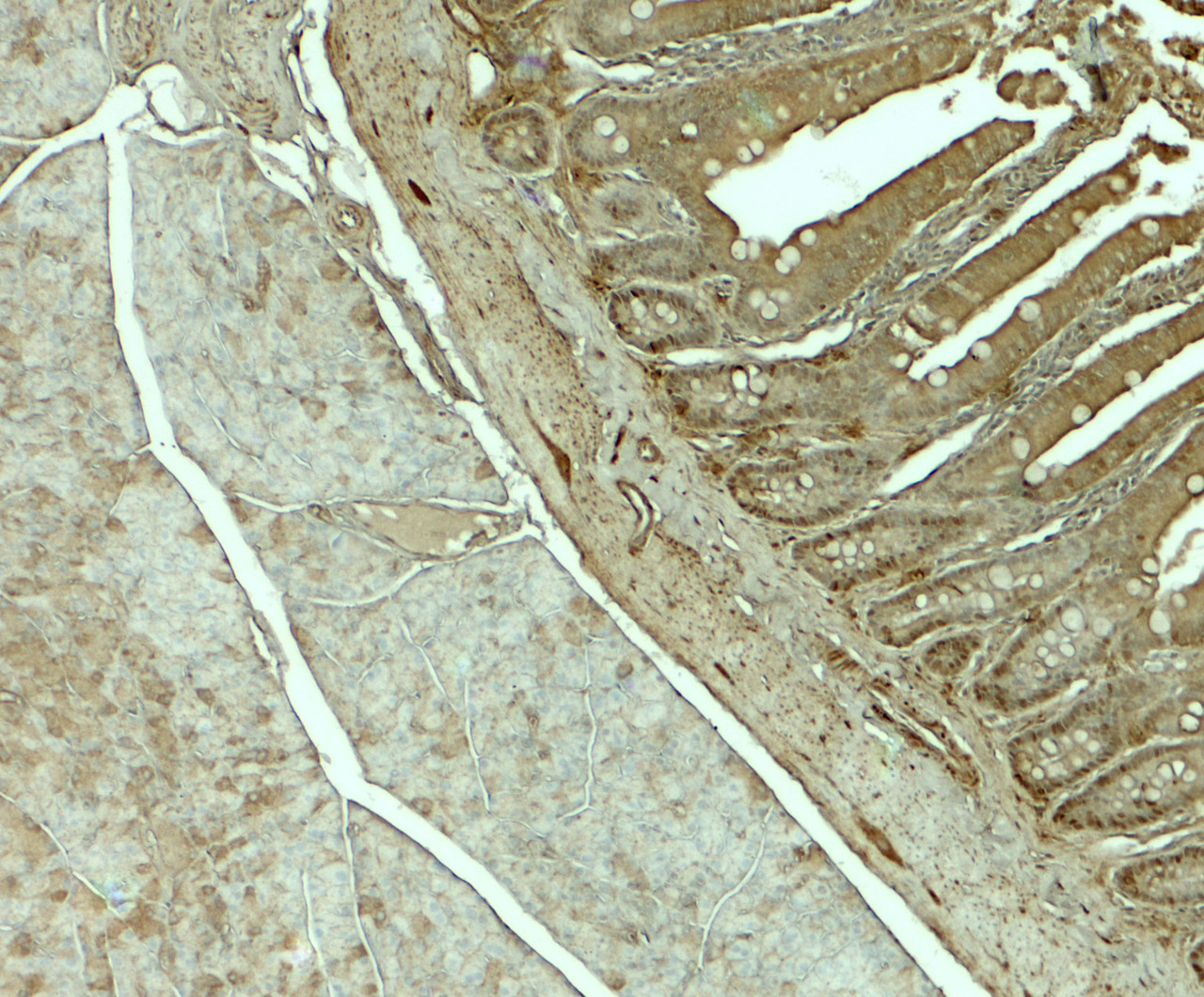Immunohistochemistry of SLC29A3 in rat colon tissue with SLC29A3 antibody at 5 ug/mL.