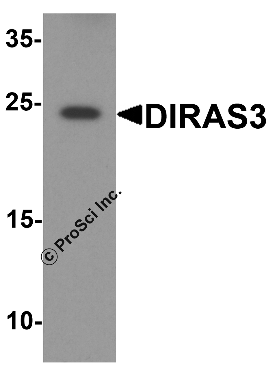 Western blot analysis of DIRAS3 in human testis tissue lysate with DIRAS3 antibody at 1 &#956;g/ml.