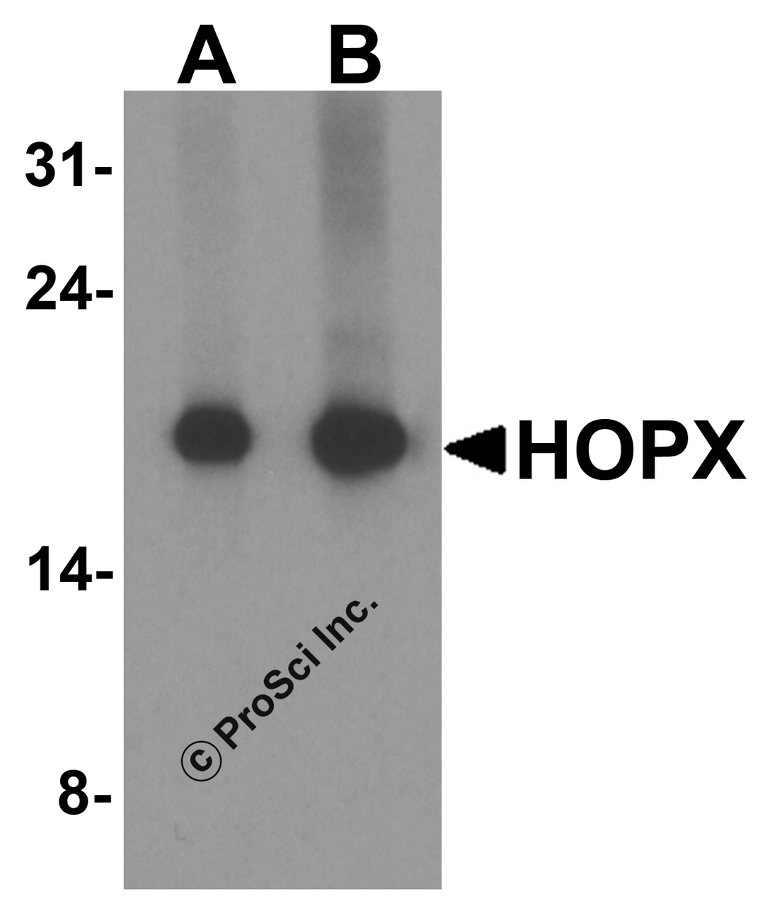 Western blot analysis of HOPX in human brain tissue lysate with HOPX antibody at (A) 1 and (B) 2 &#956;g/ml.