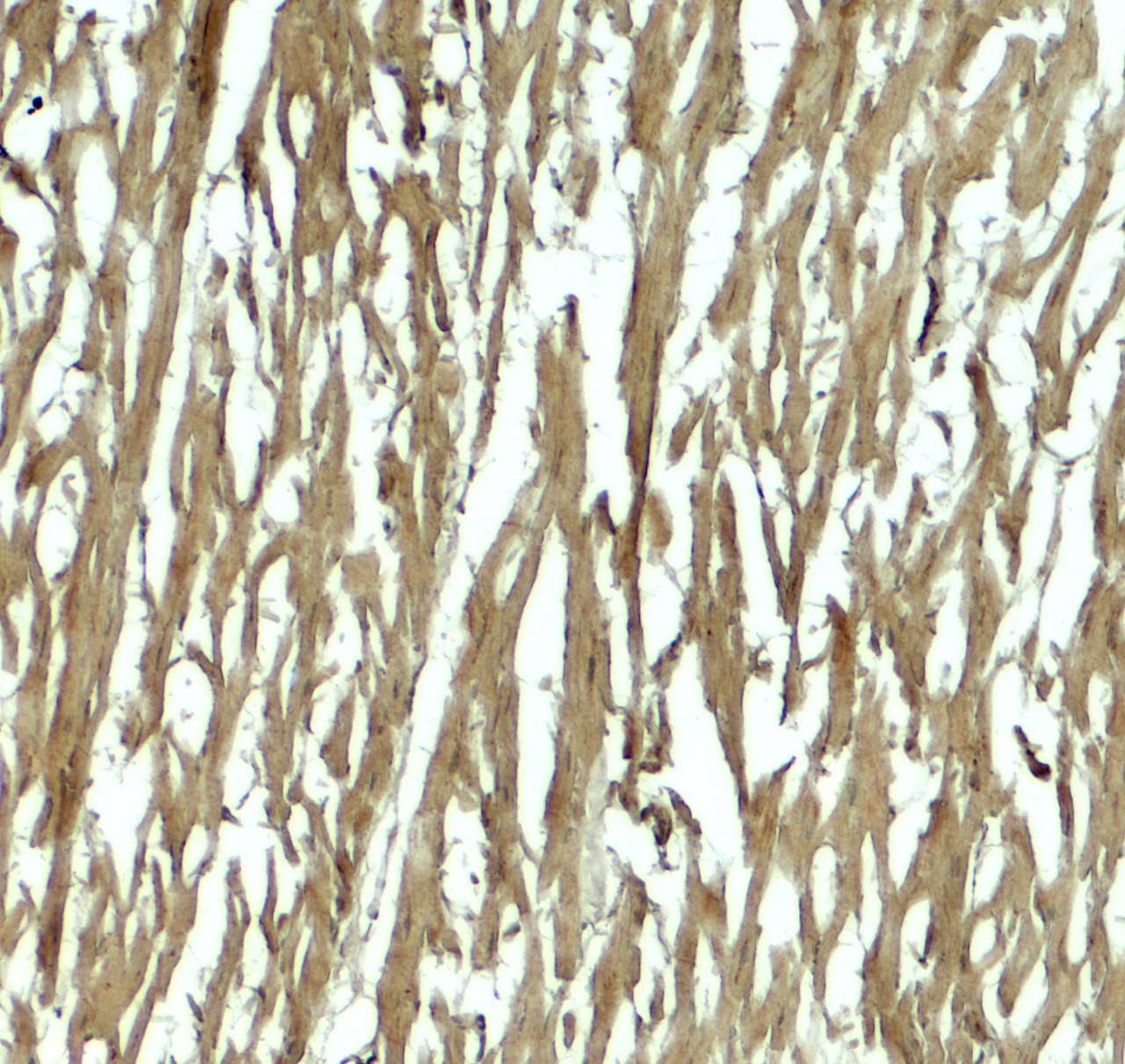 Immunohistochemistry of HOPX in human heart tissue with HOPX antibody at 5 ug/mL.