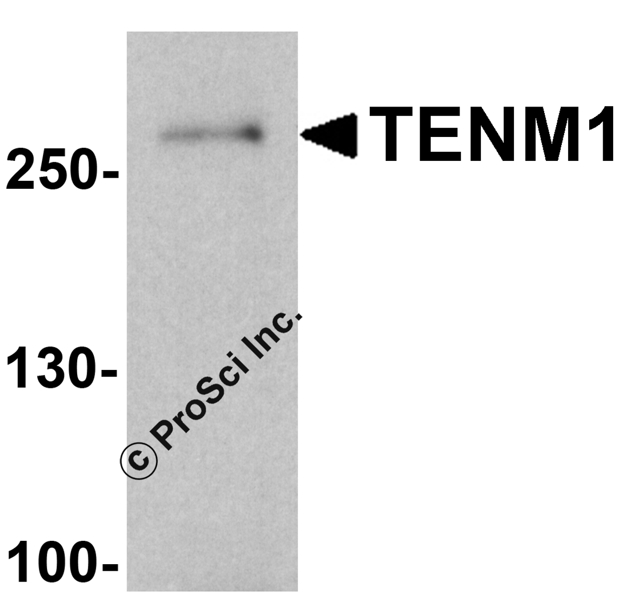 Western blot analysis of TENM1 in human brain tissue lysate with TENM1 antibody at 1 &#956;g/ml.