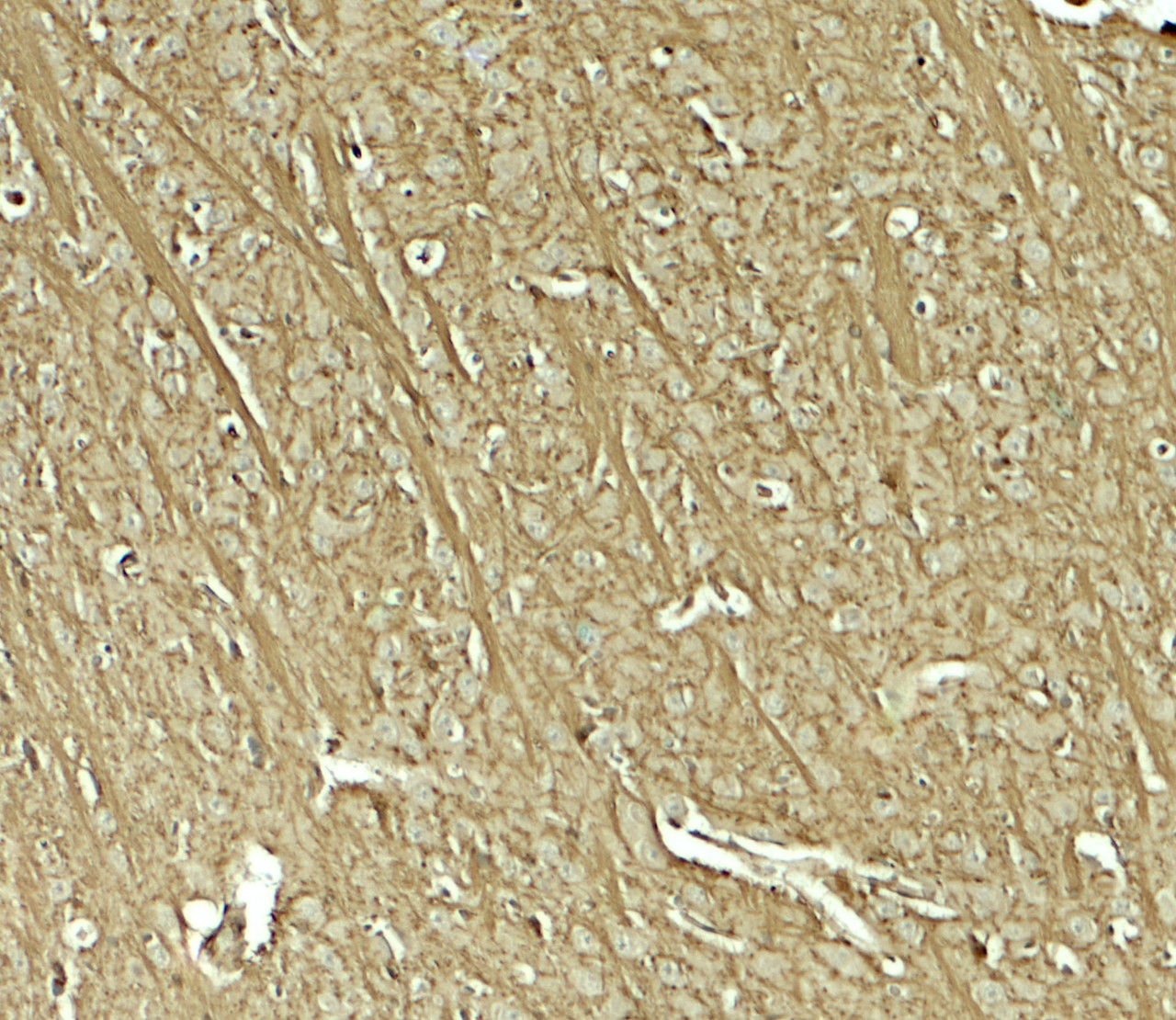 Immunohistochemistry of TENM1 in mouse brain tissue with TENM1 antibody at 5 ug/mL.