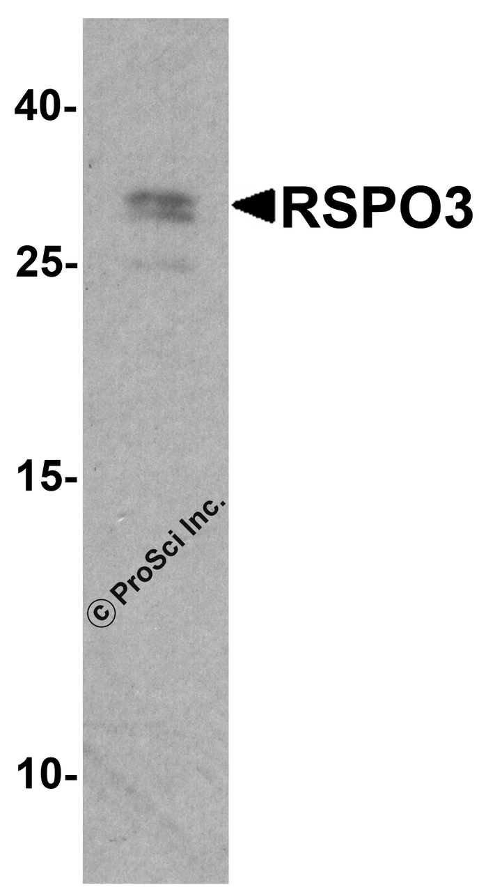 Western blot analysis of RSPO3 in 293 cell lysate with RSPO3 antibody at 1 &#956;g/ml.