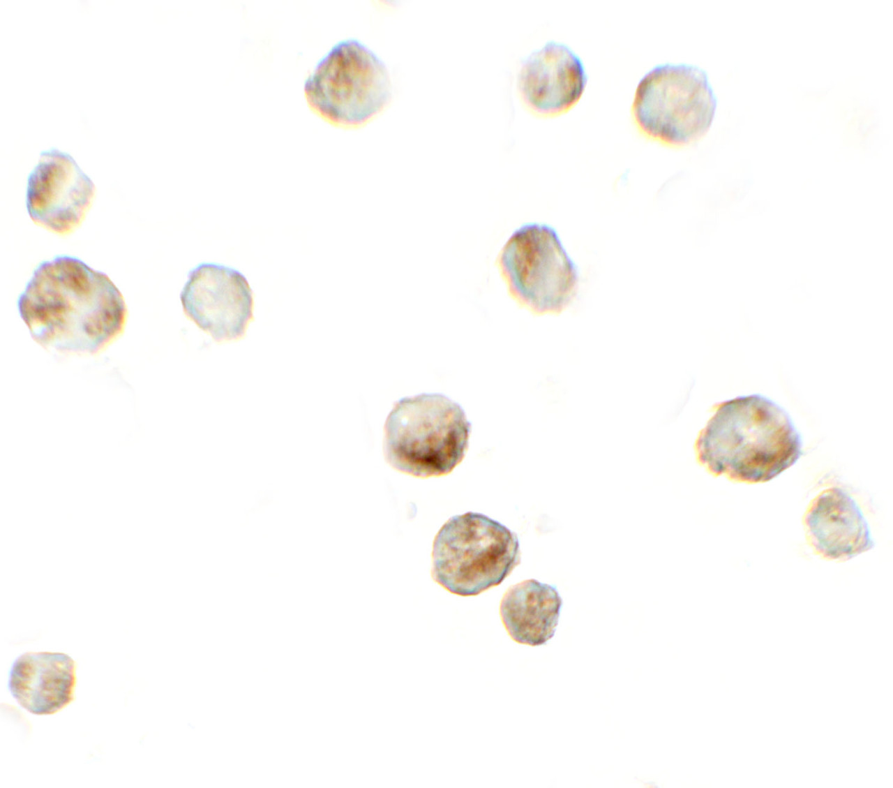 Immunocytochemistry of RSPO3 in 293 cells with RSPO3 antibody at 5 ug/mL.