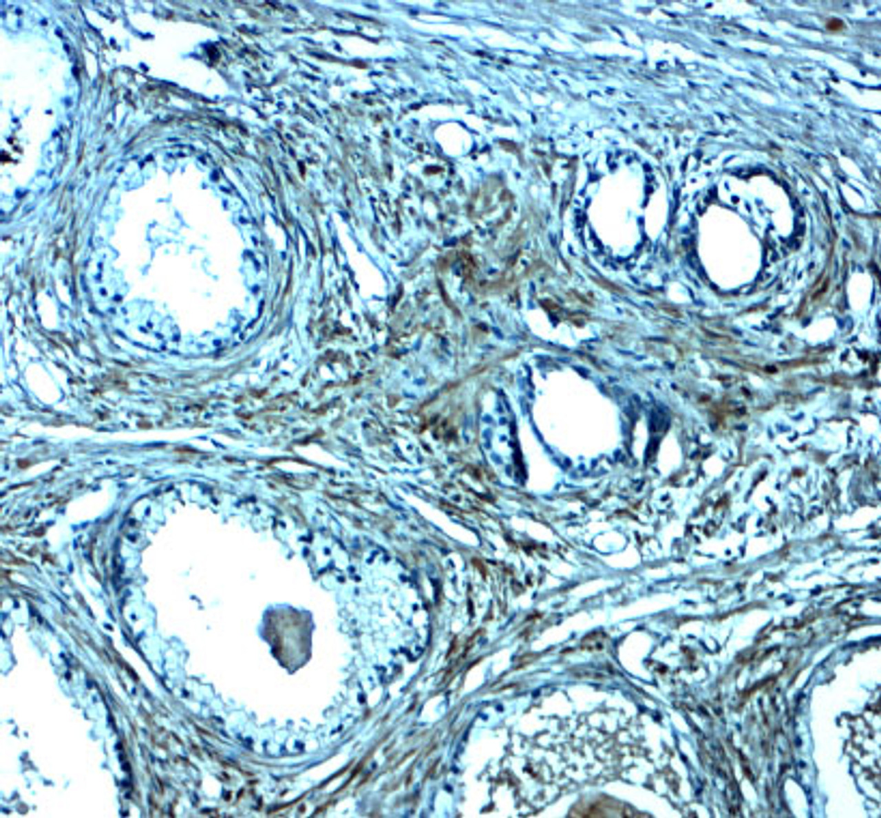 Immunohistochemistry of SPIB in human prostate tissue with SPIB antibody at 2.5 ug/mL.