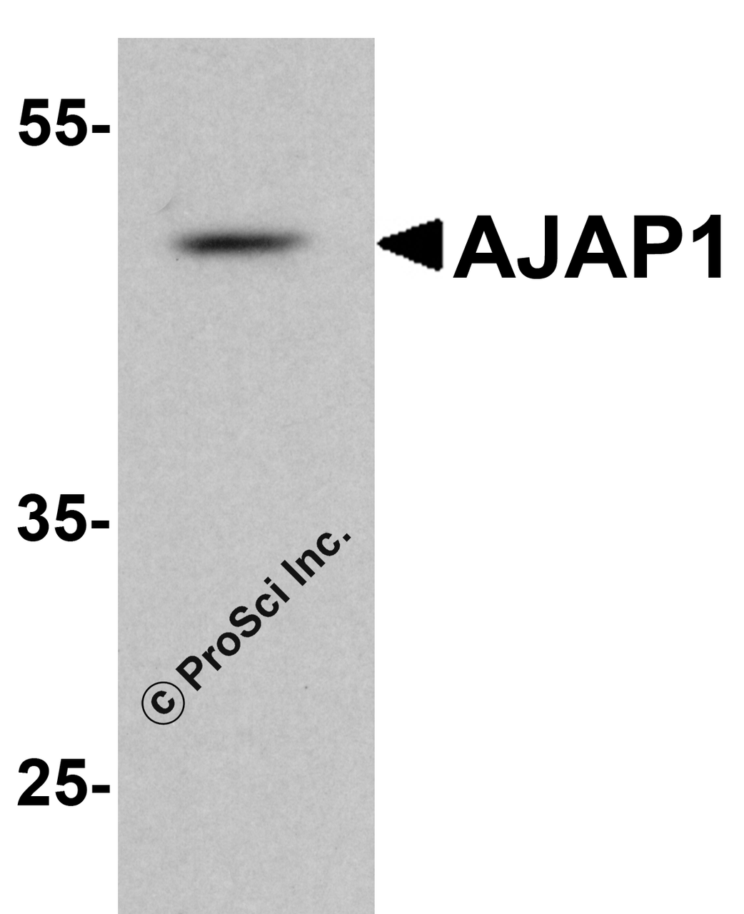 Western blot analysis of AJAP1 in rat liver tissue lysate with AJAP1 antibody at 1 &#956;g/ml.