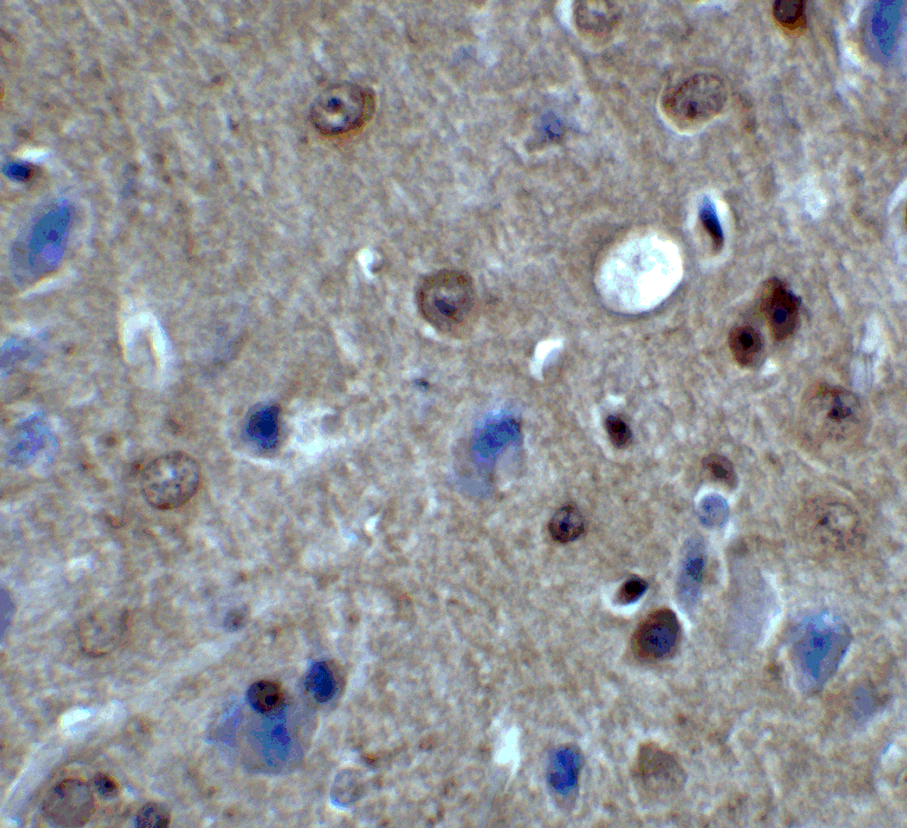 Immunohistochemistry of PACS1 in mouse brain tissue with PACS1 antibody at 2 ug/ml.