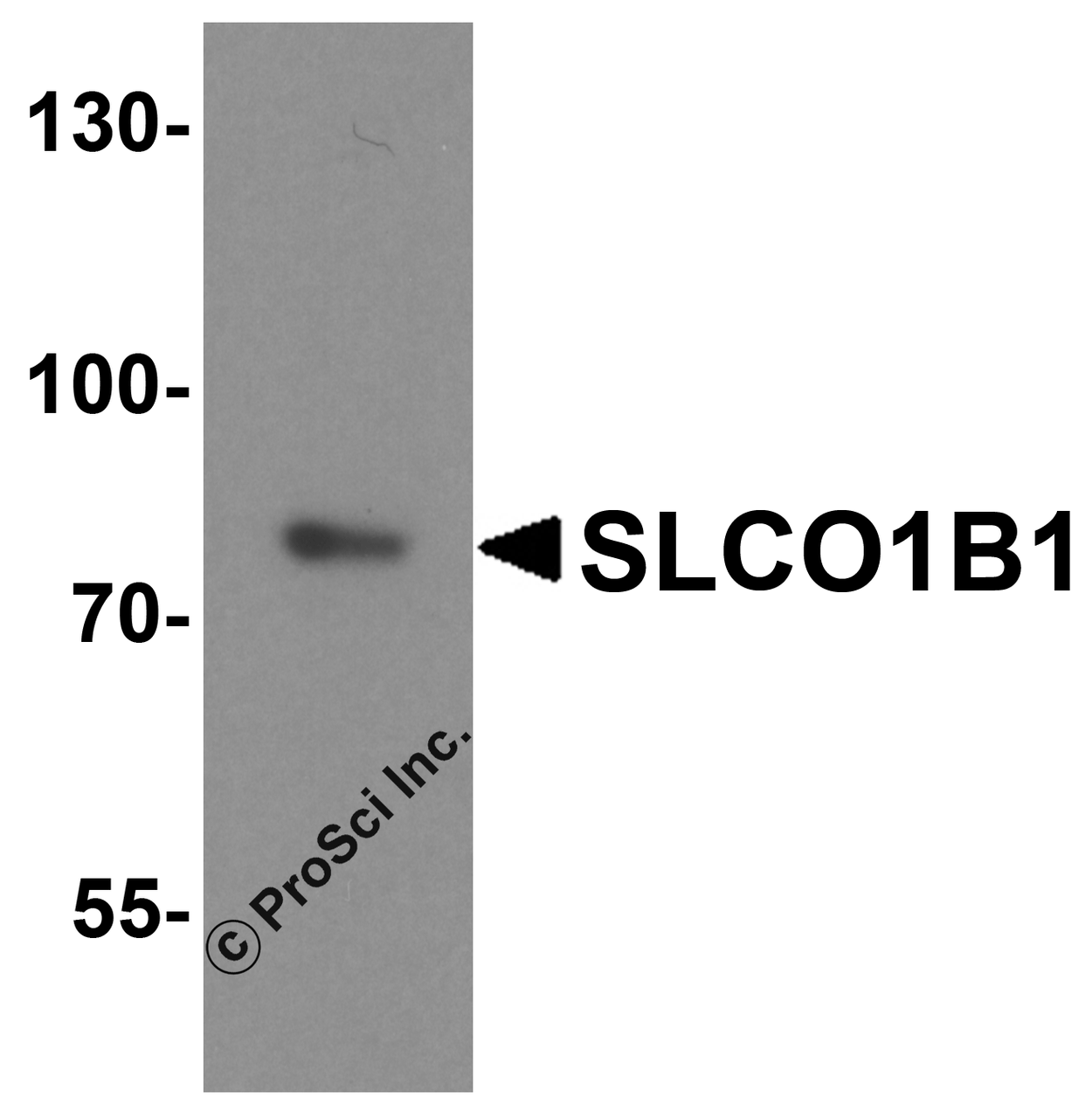 Western blot analysis of SLCO1B1 in human liver tissue lysate with SLCO1B1 antibody at 1 &#956;g/ml.