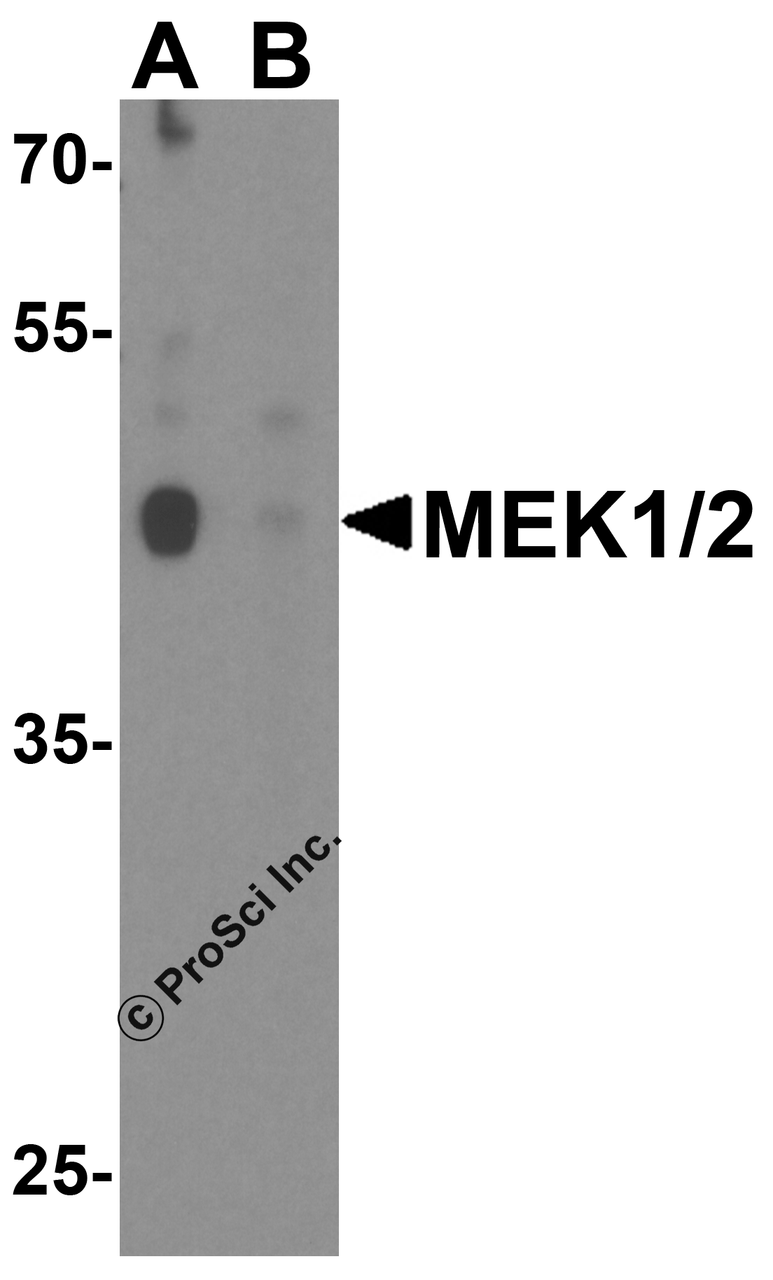 Western blot analysis of MEK1/2 in human brain tissue lysate with MEK1/2 antibody at 1 &#956;g/ml in (A) the absence and (B) the presence of blocking peptide.