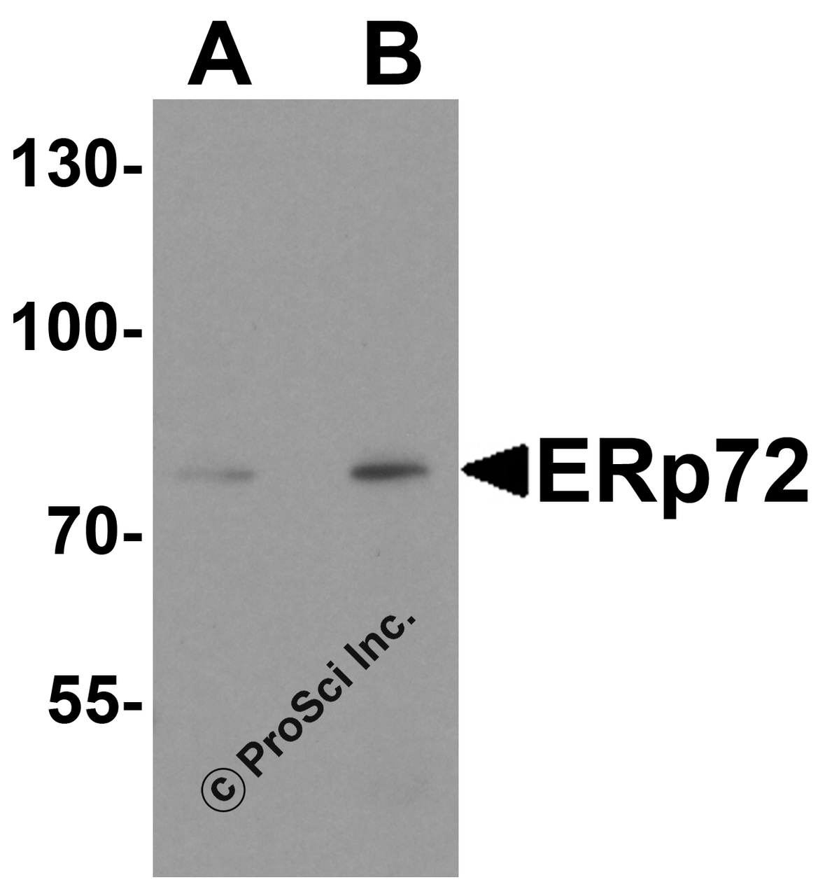 Western blot analysis of ERp72 in human colon tissue lysate with ERp72 antibody at (A) 1 and (B) 2 &#956;g/ml.