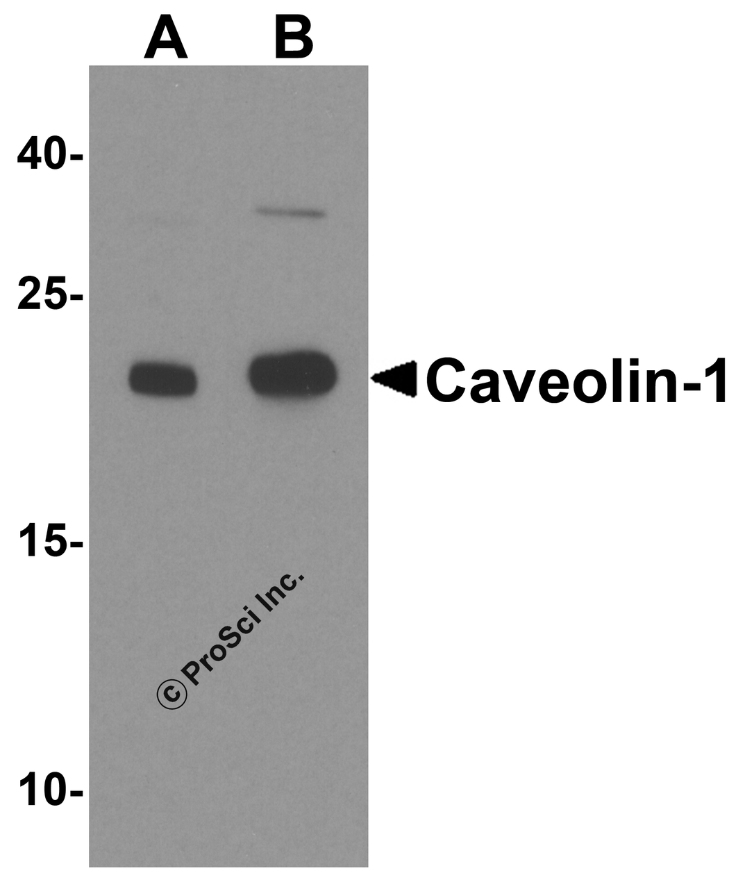 Western blot analysis of Caveolin-1 in human lung tissue lysate with Caveolin-1 antibody at (A) 1 and (B) 2 &#956;g/mL.