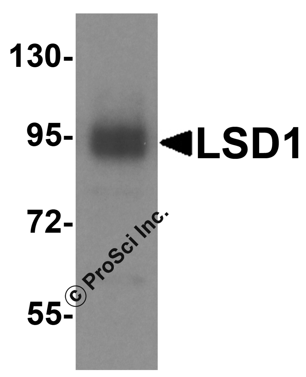 Figure 2 Western Blot Validation in Human A549 Cell Line
Loading: 15ug of lysates per lane.
Antibodies: LSD1 8223 (1 µg/mL) , 1h incubation at RT in 5% NFDM/TBST.
Secondary: Goat anti-rabbit IgG HRP conjugate at 1:10000 dilution.
