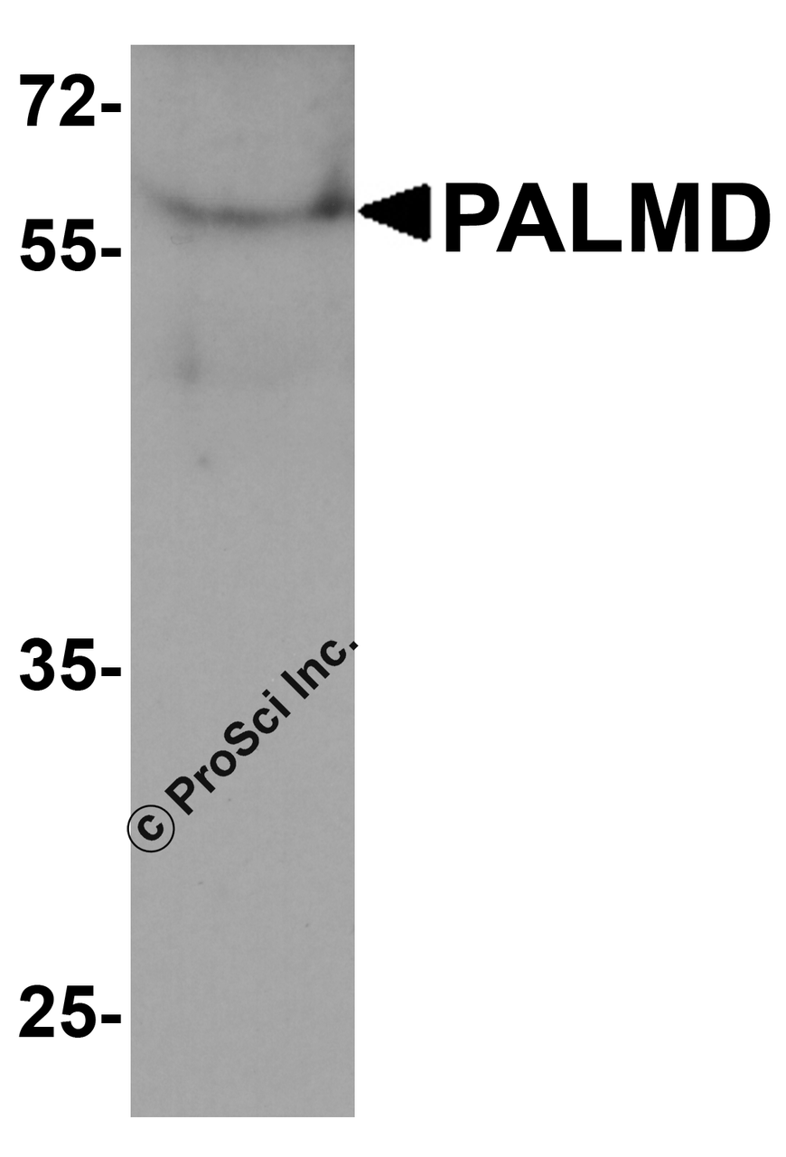 Western blot analysis of PALMD in human bladder tissue lysate with PALMD antibody at 1 &#956;g/ml.