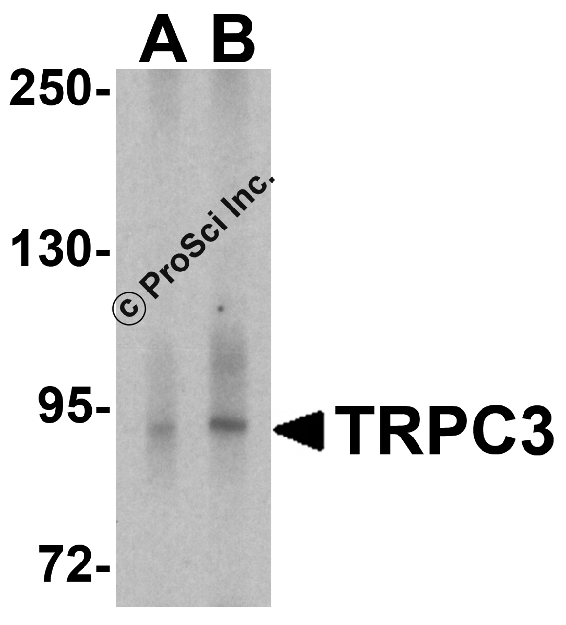 Western blot analysis of TRPC3 in human cerebellum tissue lysate with TRPC3 antibody at (A) 1 and (B) 2 &#956;g/ml.