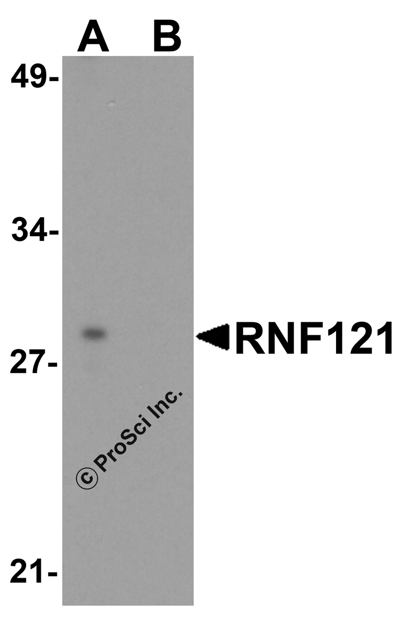 Western blot analysis of RNF121 in MCF7 cell lysate with RNF121 antibody at 1 &#956;g/ml in (A) the absence and (B) the presence of blocking peptide.