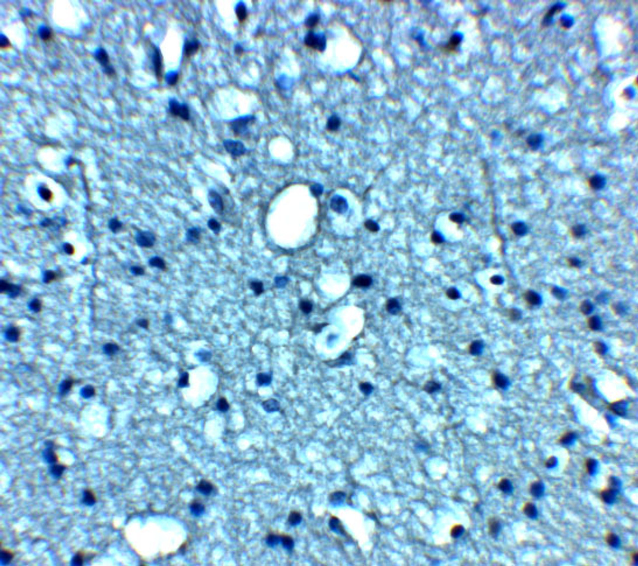 Immunohistochemistry of VTI1b in human brain tissue with VTI1b antibody at 5 ug/mL.