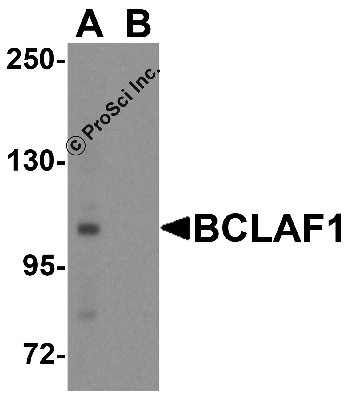 Western blot analysis of BCLAF1 in human brain tissue lysate with BCLAF1 antibody at 1 &#956;g/ml.