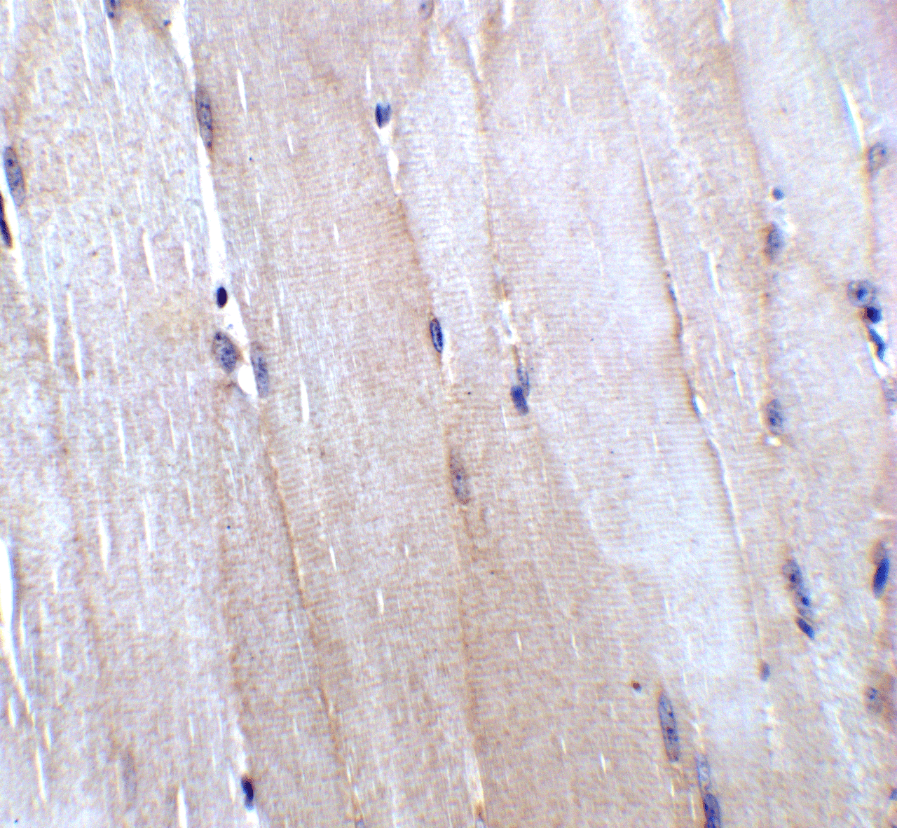 Immunohistochemistry of CHADL in mouse skeletal muscle tissue with CHADL antibody at 5 ug/mL.