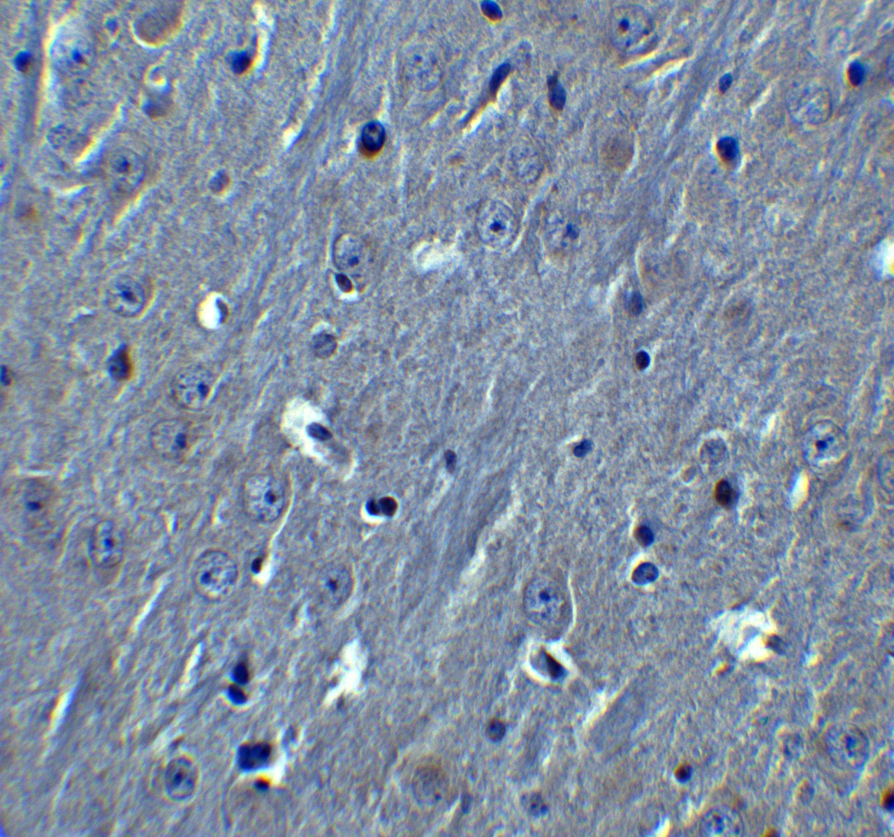 Immunohistochemistry of HOOK3 in mouse brain tissue with HOOK3 antibody at 10 ug/ml.