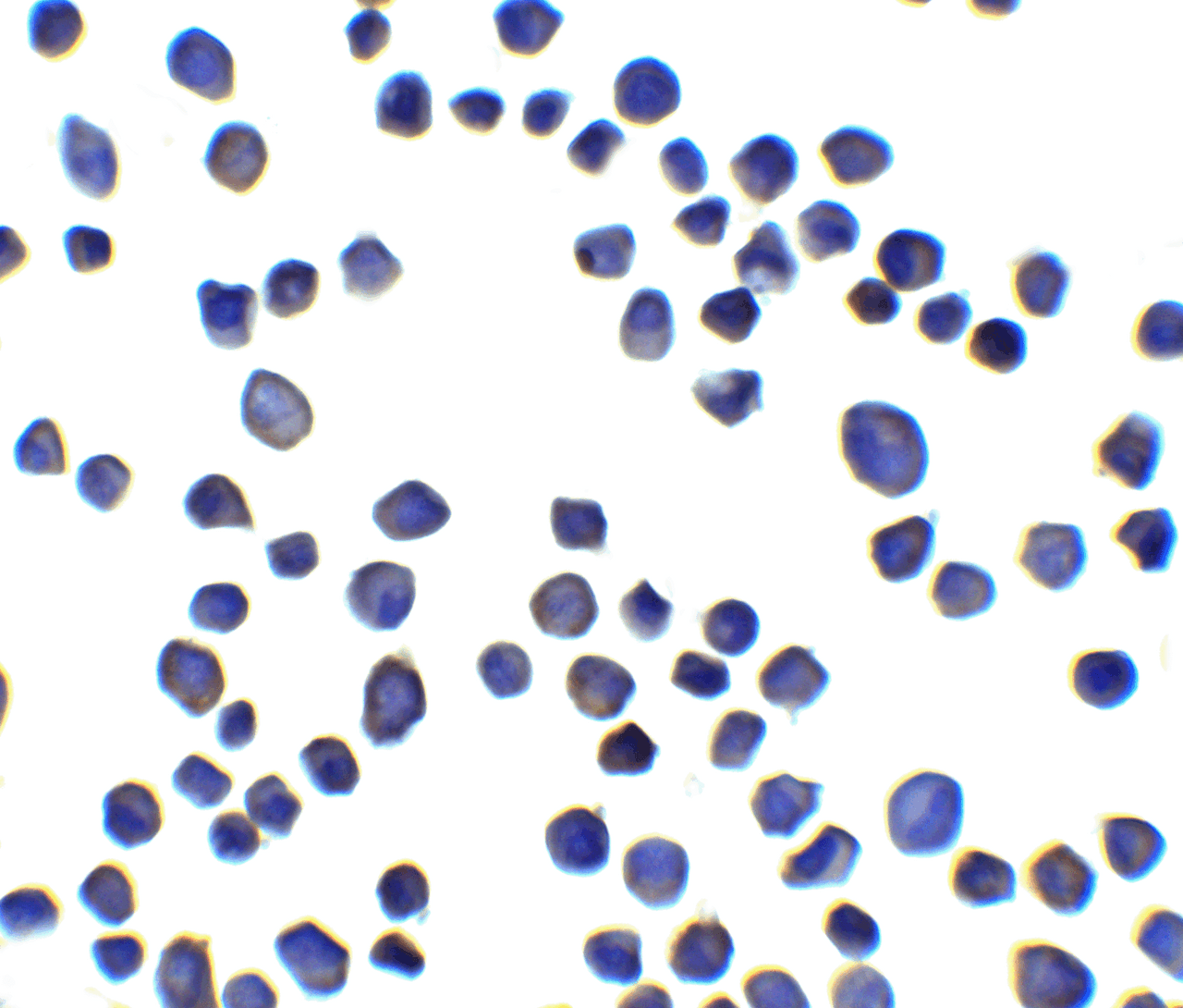 Immunocytochemistry of SUSD3 in 3T3 cells with SUSD3 antibody at 5 ug/ml.