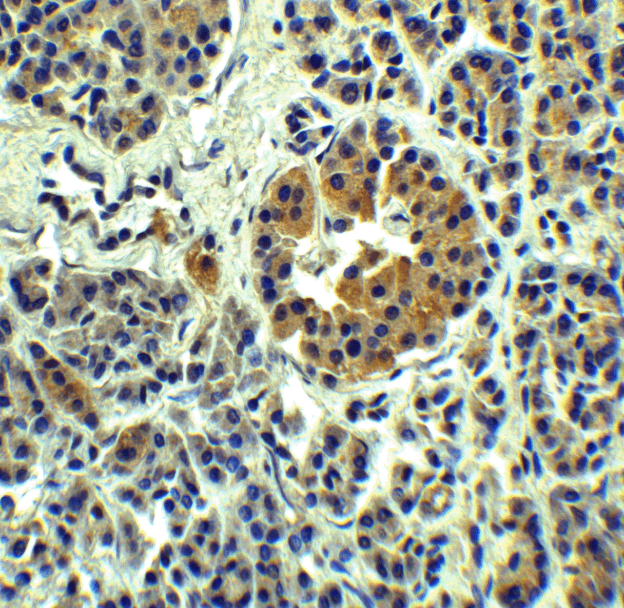 Immunohistochemistry of SLC30A8 in human pancreas tissue with SLC30A8 Antibody at 5 ug/mL.