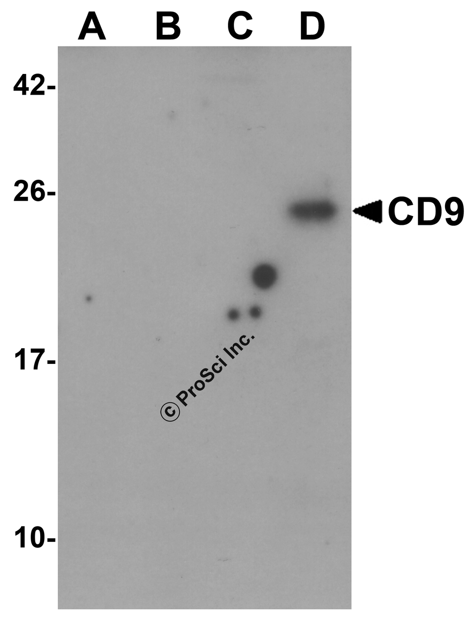 Western blot analysis of CD9 in (A) human ovary, (B) human uterus, (C) human ovary tumor, and (D) human uterus tumor tissue lysate with CD9 antibody at 1 &#956;g/ml.