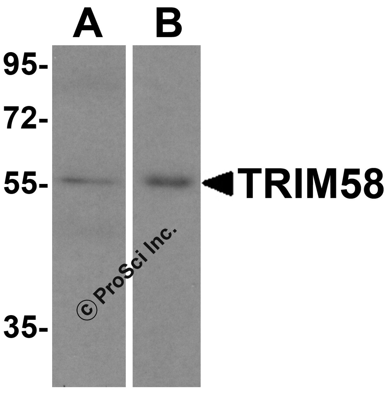Western blot analysis of TRIM58 in (A) human heart tissue and (B) mouse kidney lysate with TRIM58 antibody at 1 &#956;g/mL.