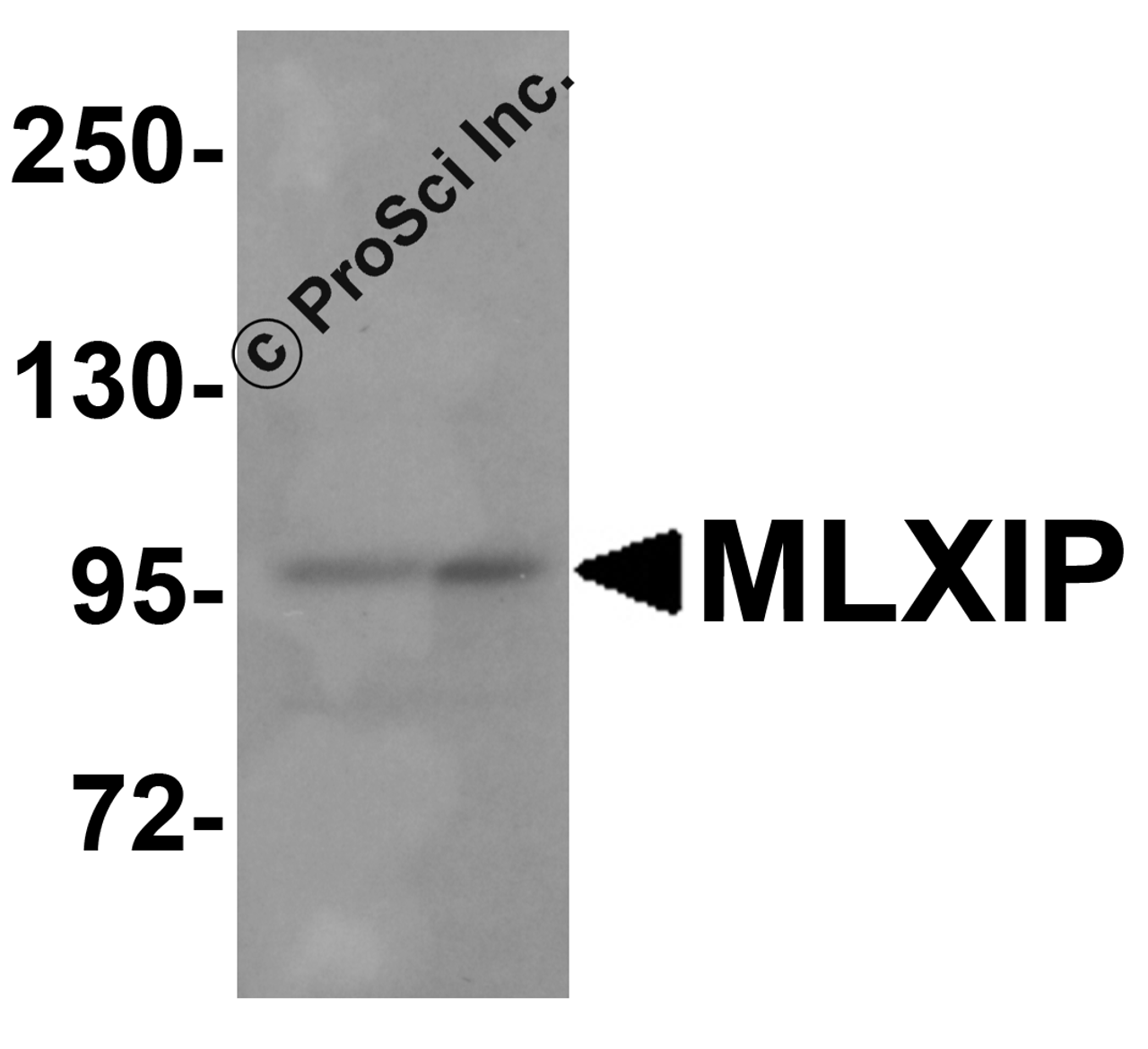 Western blot analysis of MLXIP in MCF7 cell lysate with MLXIP antibody at 1 &#956;g/mL.
