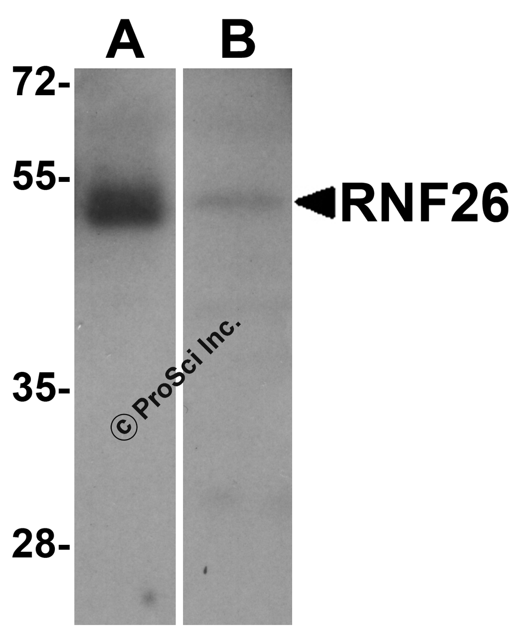 Western blot analysis of RNF26 in (A) human tonsil and (B) rat stomach tissue lysate with RNF26 antibody at 1 &#956;g/mL.