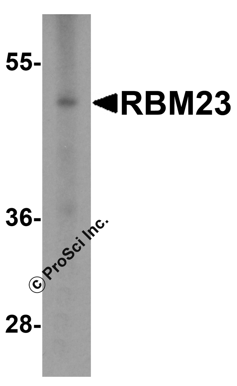 Western blot analysis of RBM23 in (A) human tonsil and (B) rat stomach tissue lysate with RBM23 antibody at 1 &#956;g/mL.