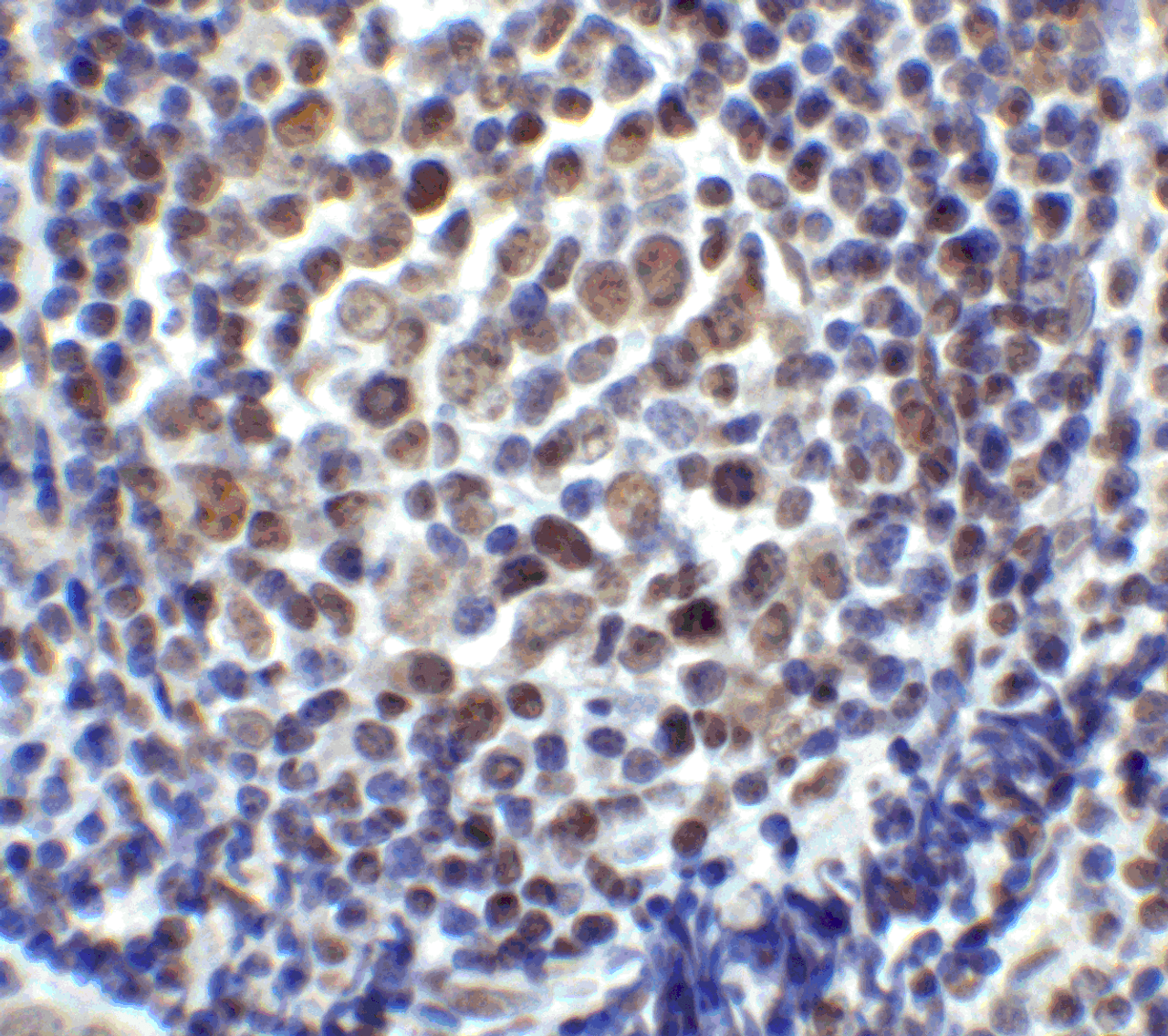 Immunohistochemistry of LAG3 in human tonsil tissue with LAG3 antibody at 2 ug/ml.