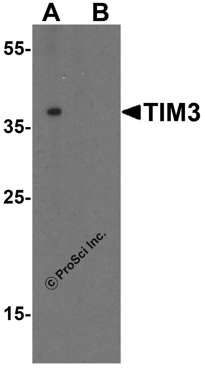 Western blot analysis of TIM-3 in Jurkat cell lysate with TIM-3 antibody at 1 &#956;g/mL in (A) the absence and (B) the presence of blocking peptide.