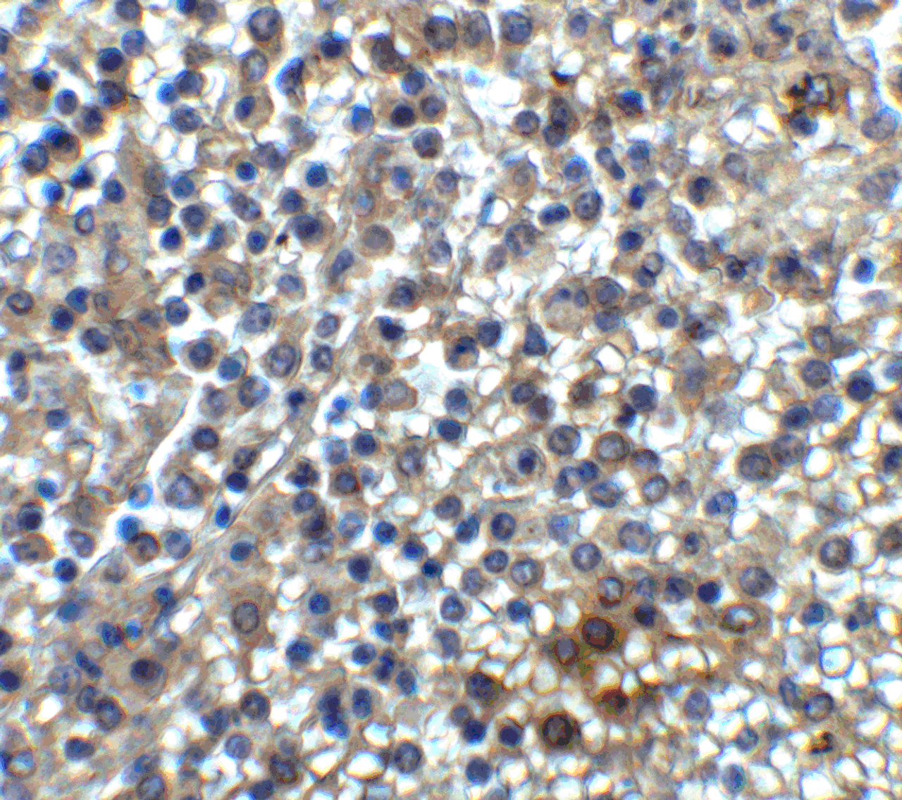 Immunohistochemistry of TIM-3 in human spleen tissue with TIM-3 antibody at 2 ug/ml.