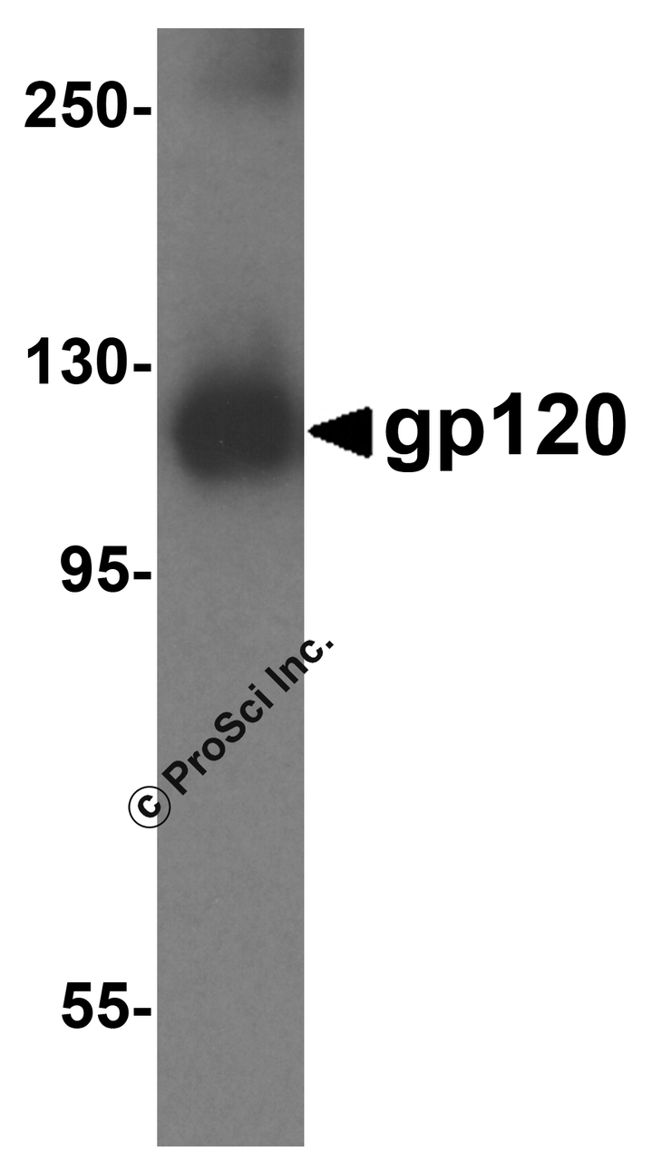 Western blot analysis 1 ng of recombinant gp120 with gp120 antibody at 1 &#956;g/mL.