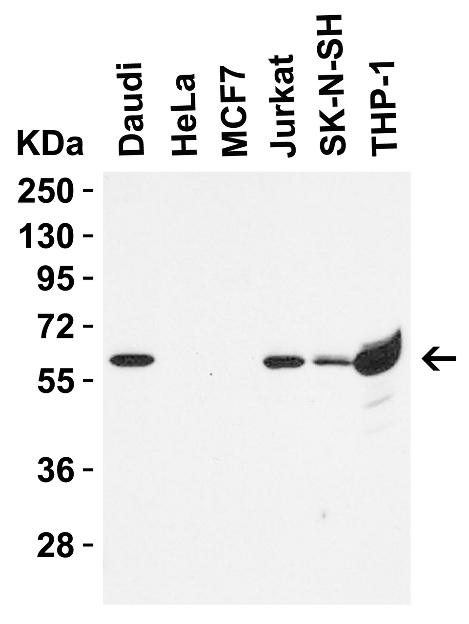 Figure 1 Western Blot Validation in Human Cell Lines
Loading: 15 &#956;g of lysates per lane.
Antibodies: hRIP3, 8963 (0.5 &#956;g/mL) , 1h incubation at RT in 5% NFDM/TBST.
Secondary: Goat anti-rabbit IgG HRP conjugate at 1:10000 dilution.