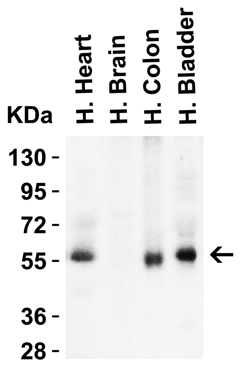 Figure 2 Western Blot Validation in Human Tissues
Loading: 15 ug of lysates per lane.
Antibodies: hRIP3, 8963 (1 ug/mL) , 1h incubation at RT in 5% NFDM/TBST.
Secondary: Goat anti-rabbit IgG HRP conjugate at 1:10000 dilution.
