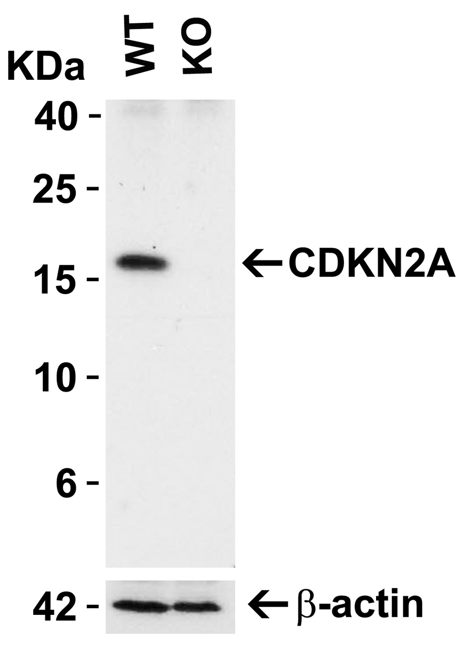 Figure 1 KO Validation of CDKN2A in 293 Cells 
Loading: 10 &#956;g of 293 WT cell lysates or CDKN2A KO cell lysates. Antibodies: CDKN2A, 8975 (2 &#956;g/mL) and beta-actin, 3779 (1 &#956;g/mL) , 1 h incubation at RT in 5% NFDM/TBST.
Secondary: Goat Anti-Rabbit IgG HRP conjugate at 1:10000 dilution.