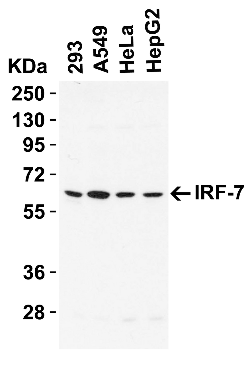 Figure 2 Western Blot Validation in Human Cell Lines
Loading: 15 ug of lysates per lane.
Antibodies: IRF7, 8991, (1 ug/mL) , 1h incubation at RT in 5% NFDM/TBST.
Secondary: Goat anti-rabbit IgG HRP conjugate at 1:10000 dilution.