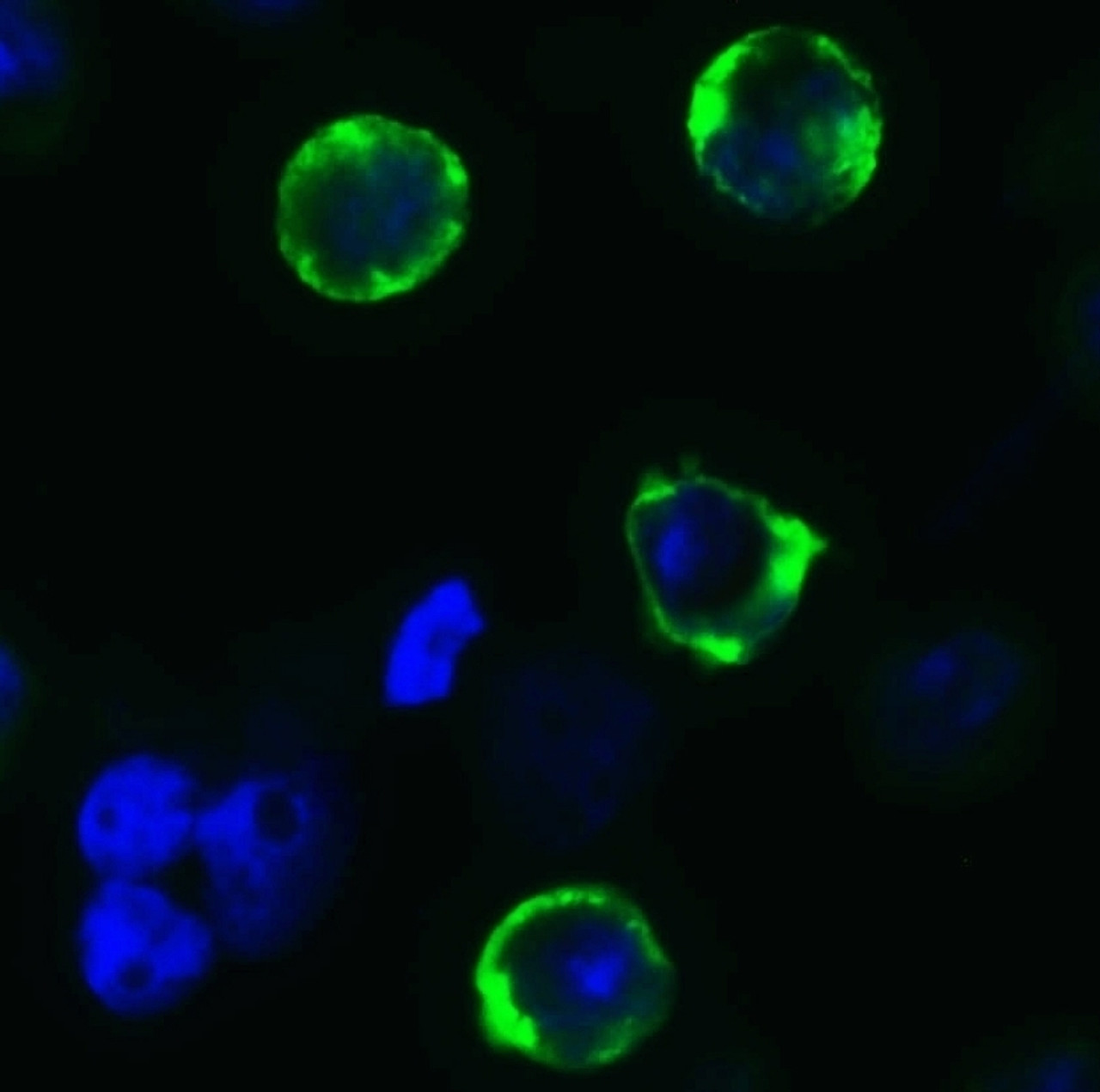 Figure 2 Immunofluorescence Validation of SARS-CoV-2 (COVID-19) Spike (cleavage site) in 293 Transfected CellsImmunofluorescent analysis of 4% paraformaldehyde-fixed Spike transfected 293cells labeling SARS-CoV-2 (COVID-19) Spike (cleavage site) with 9091 at 10 mg/mL, followed by goat anti-rabbit IgG secondary antibody at 1/500 dilution (green) and DAPI staining (blue) .