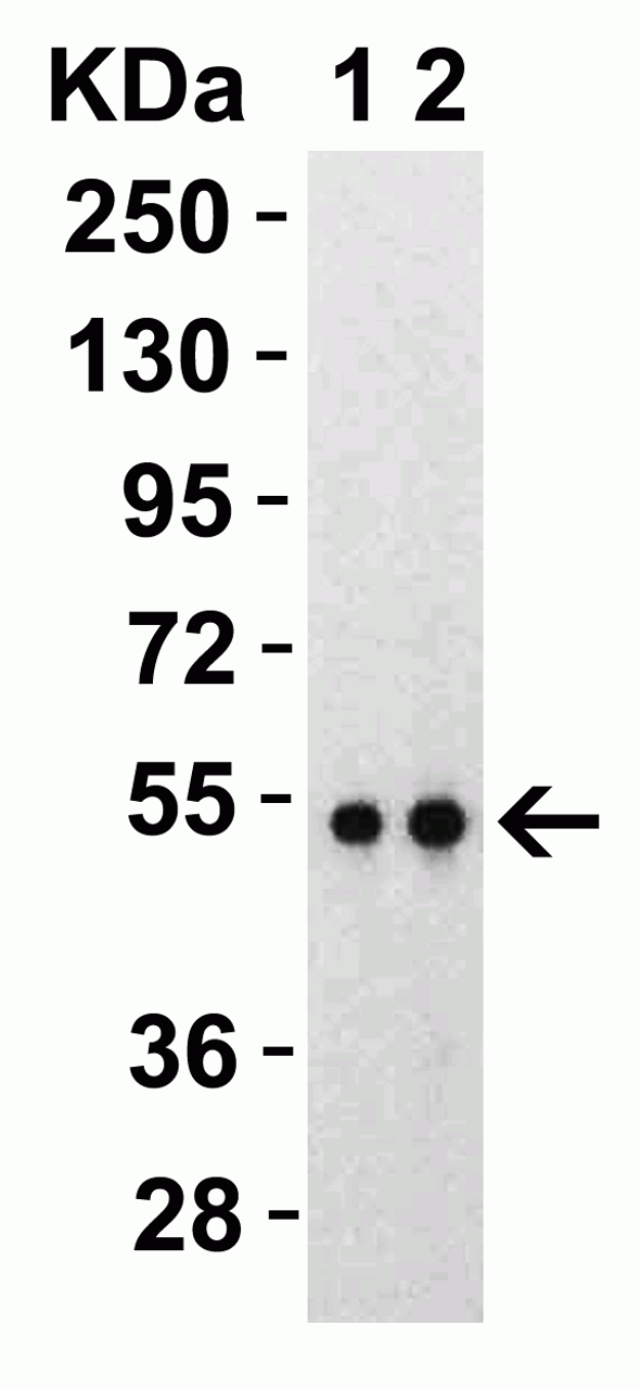 Figure 1 Western Blot Validation with SARS-CoV-2 (COVID-19) Nucleocapsid Recombinant Protein Loading: 30 ng per lane of SARS-CoV-2 (COVID-19) Nucleocapsid recombinant protein, 10-306. Antibodies: SARS-CoV-2 (COVID-19) Nucleocapsid, 9103, 1h incubation at RT in 5% NFDM/TBST. Secondary: Goat anti-rabbit IgG HRP conjugate at 1:10000 dilution. Lane 1: 1 &#956;g/mL and Lane 2: 2 &#956;g/mL.