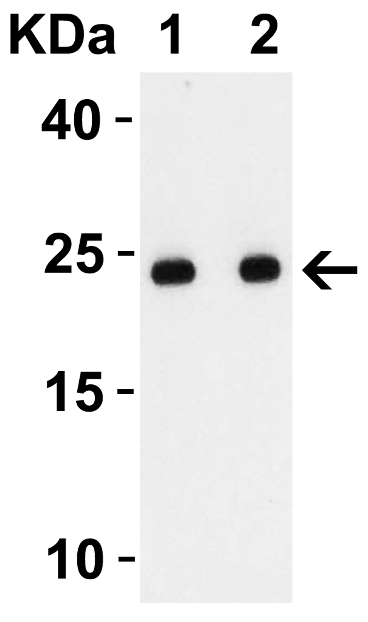Figure 2 Western Blot Validation with SARS-CoV-2 Envelope Recombinant Protein
Loading: 50 ng per lane of SARS-CoV-2 Envelope recombinant protein (92-730) .
Antibodies: SARS-CoV-2 (COVID-19) Envelope, 9169, 1h incubation at RT in 5% NFDM/TBST.
Secondary: Goat anti-rabbit IgG HRP conjugate at 1:10000 dilution.
Lane 1: 1 ug/mL and 
Lane 2: 2 ug/mL