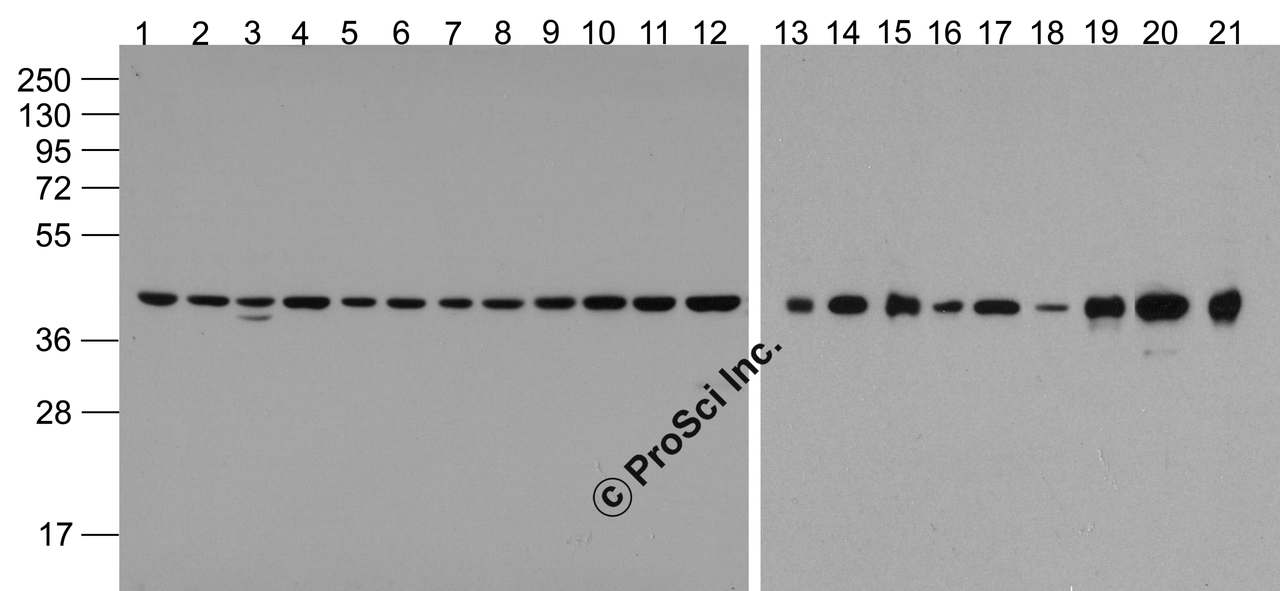 Western blot analysis of beta-Actin (HRP) in 293, A431, A549, Daudi, HeLa, HepG2, Jurkat, K562, MOLT4, 3T3, Raji, THP-1, mouse brain, rat brain, rabbit brain, mouse lung, rat lung, rat liver, rabbit spleen, chicken small intestine, and drosophila lysate with beta-Actin Antibody (HRP) at 1 &#956;g/mL.