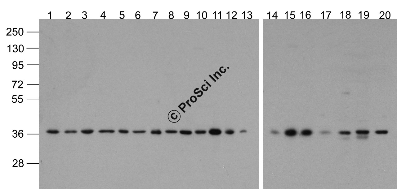 Western blot analysis of GAPDH in 293, A431, A549, Daudi, HeLa, HepG2, Jurkat, K562, MOLT4, 3T3, Raji, Ramos, U937, human brain, mouse brain, rat brain, mouse lung, mouse liver, rat liver, and chicken small intestine lysate with Biotin-GAPDH antibody at 1 &#956;g/mL.