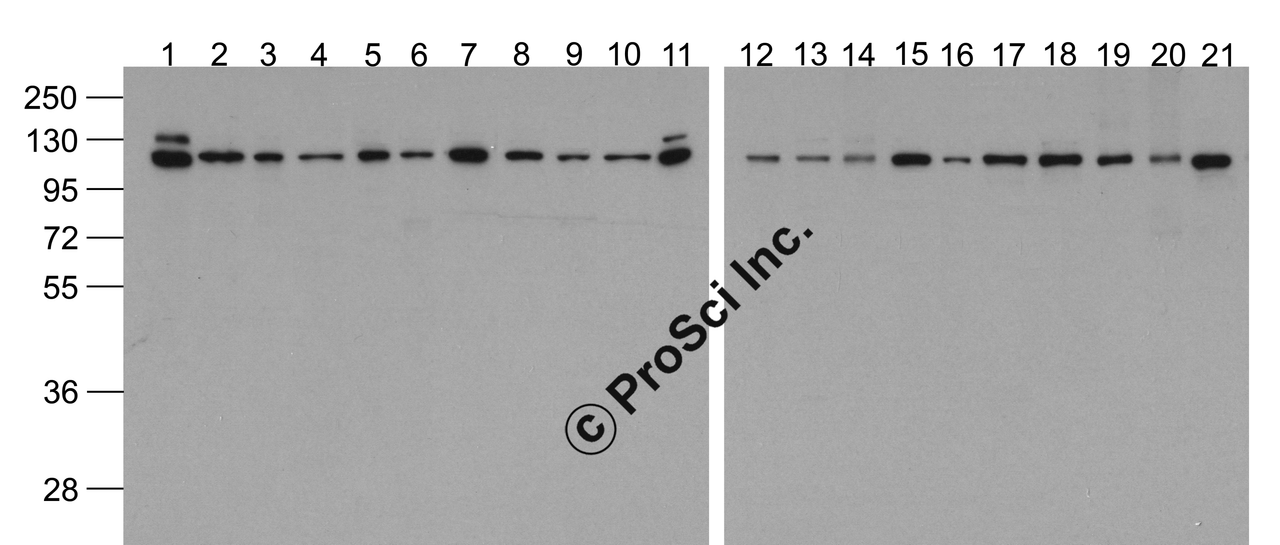 Western blot analysis of Vinculin in 293, A431, A549, Daudi, HeLa, HepG2, K562, 3T3, Raji, U937 cell lysate and mouse brain, rat brain, rabbit brain, mouse lung, rat lung, mouse liver, rat liver, rabbit spleen, chicken liver and chicken small intestine tissue lysate with Biotin-Vinculin antibody at 1 &#956;g/ml.