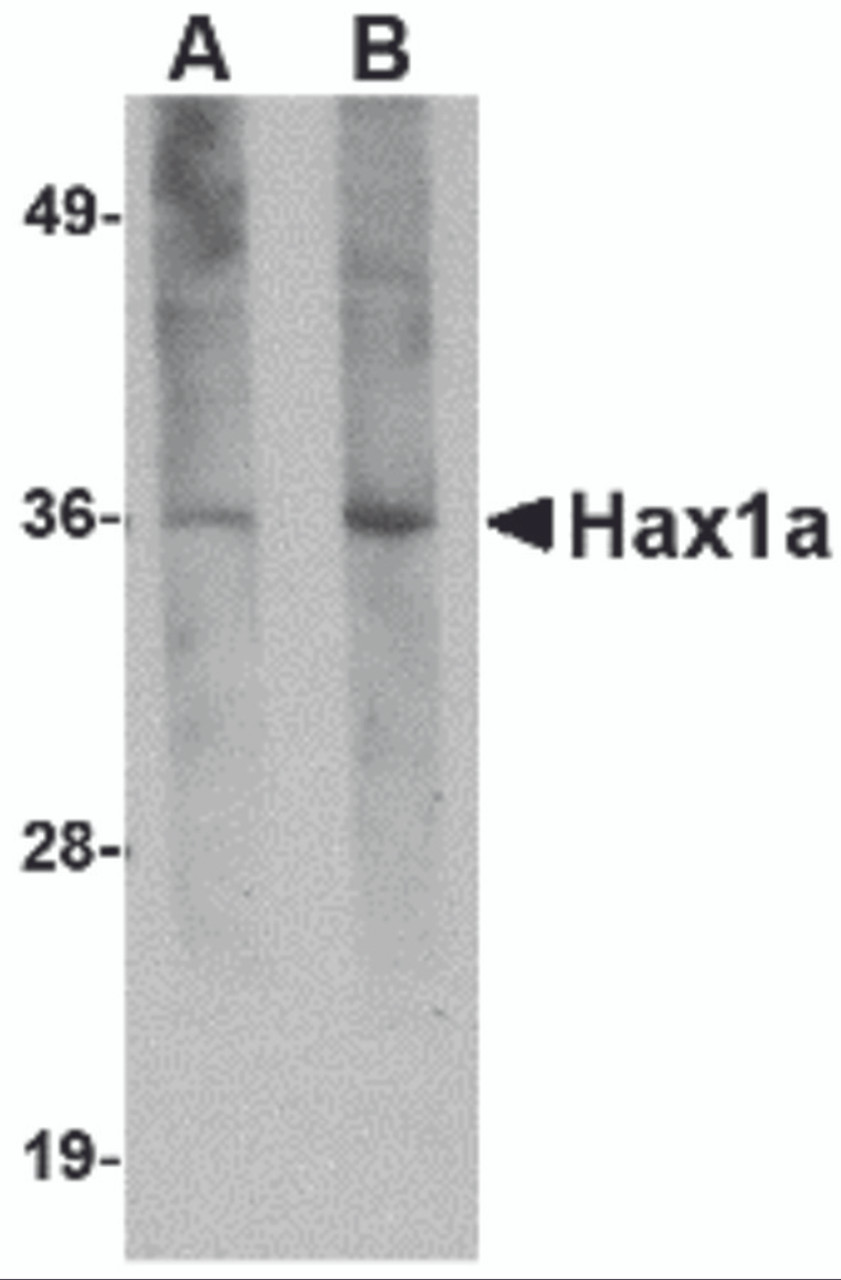 Western blot analysis of Hax1a in human brain tissue lysate with Hax1a antibody at (A) 1 and (B) 2 &#956;g/mL.