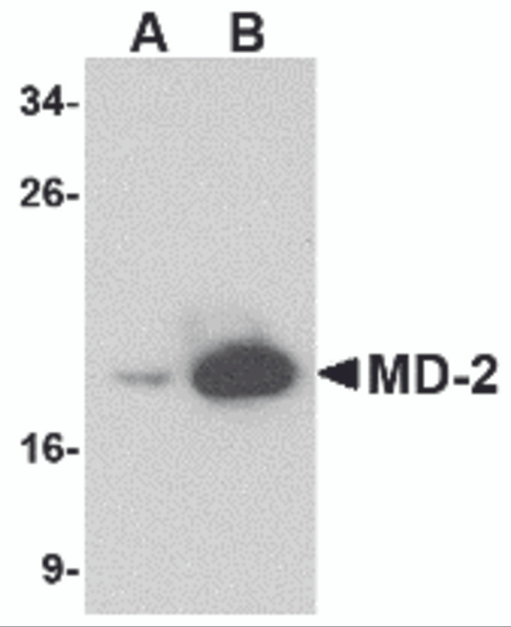 Western blot analysis of (A) 25 and (B) 125 ng of MD-2 recombinant protein with MD-2 antibody at 1 &#956;g/mL.