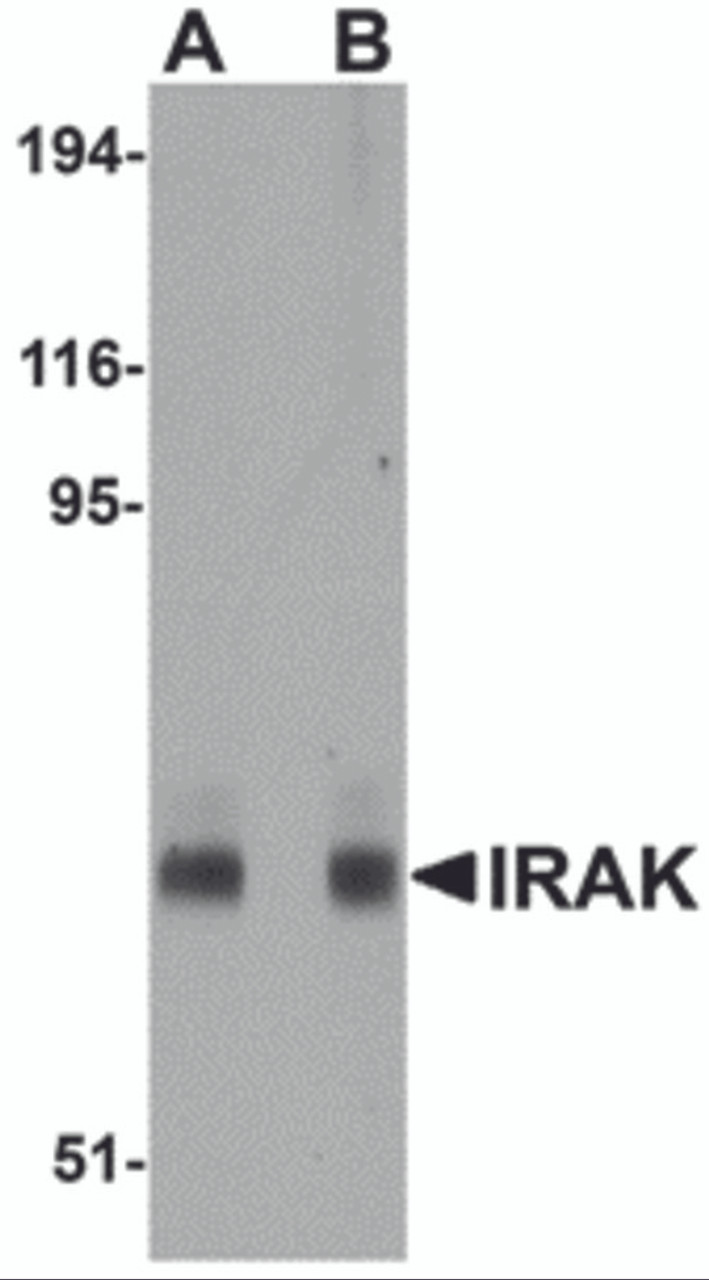 Western blot analysis of IRAK in mouse liver lysate with IRAK antibody at (A) 1 and (B) 2 &#956;g/mL.